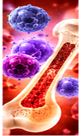 Respiratory Infections